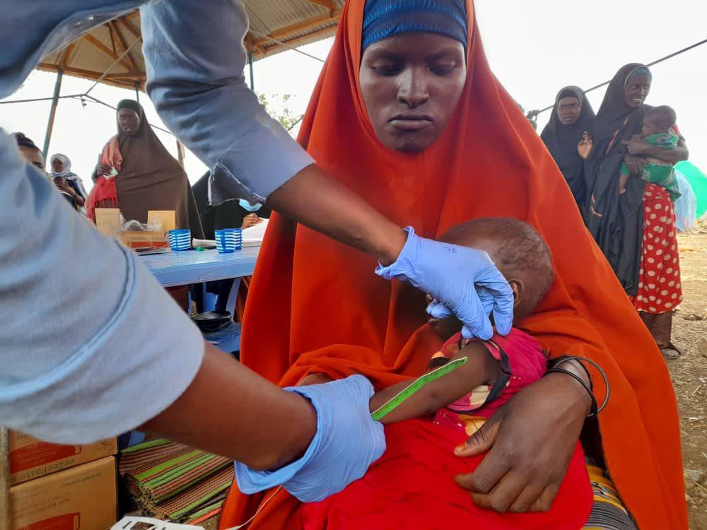 18-moths-old Baby being attended to by nurse during the Malnutrition Crisis in Baidoa