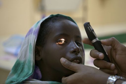 MSF: successfully completed a special eye surgery camp