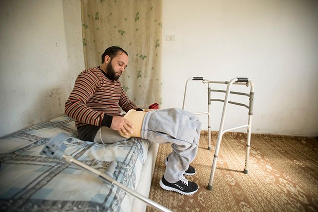 Omar Al Balkhi, 29, is a Syrian war-wounded patient. Photo: MSF