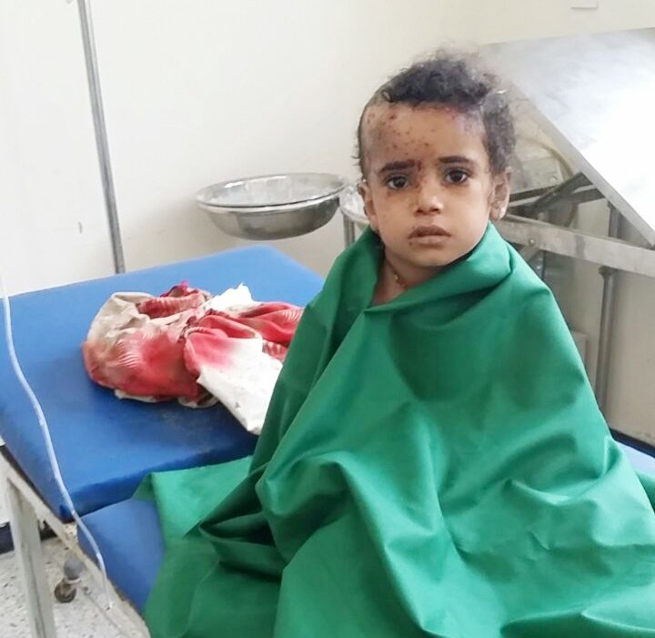 After intensive fighting in Taiz