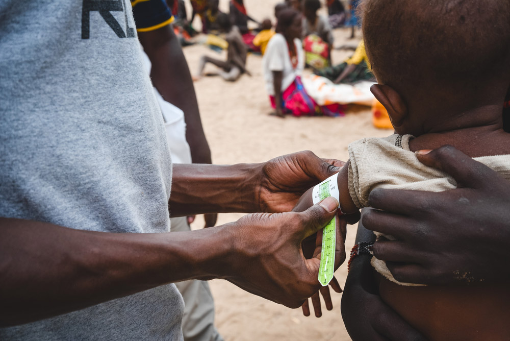 MSF, Doctors Without Borders, Kenya, Malnutrition crisis