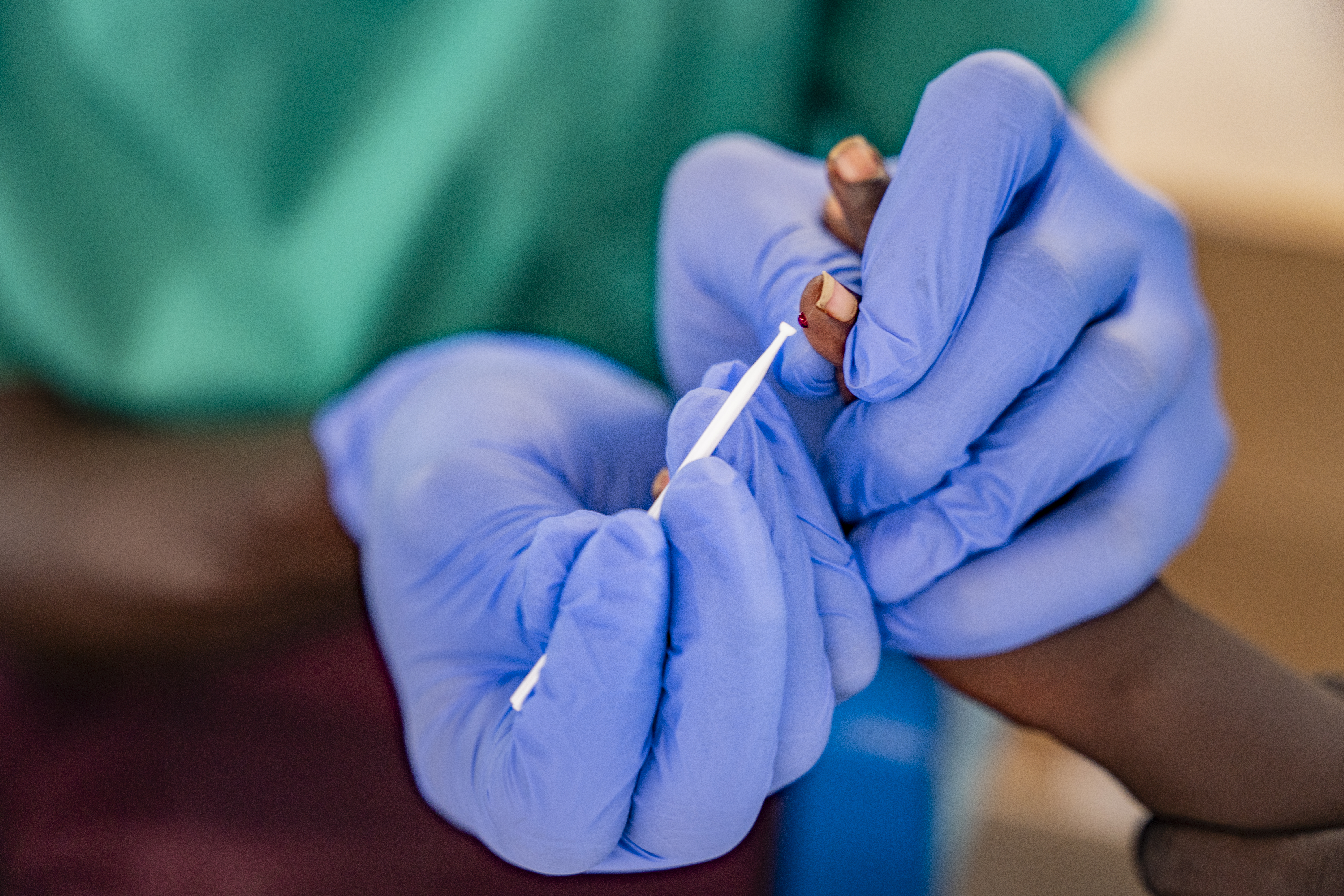 Doctors Without Borders, MSF, Malaria in South Sudan