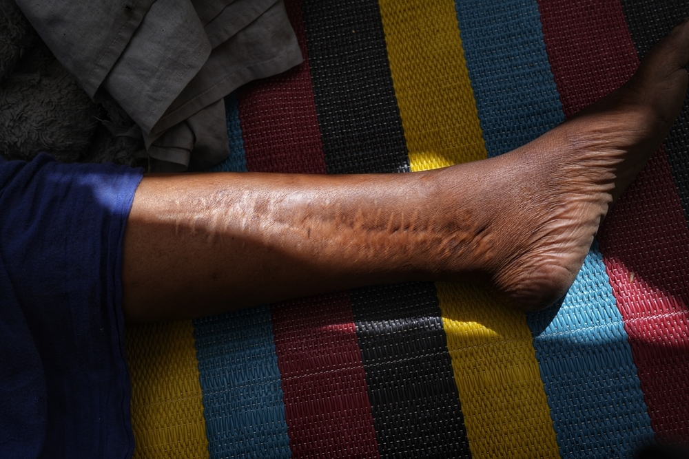 Doctors Without Borders, MSF, Two years of war in Sudan