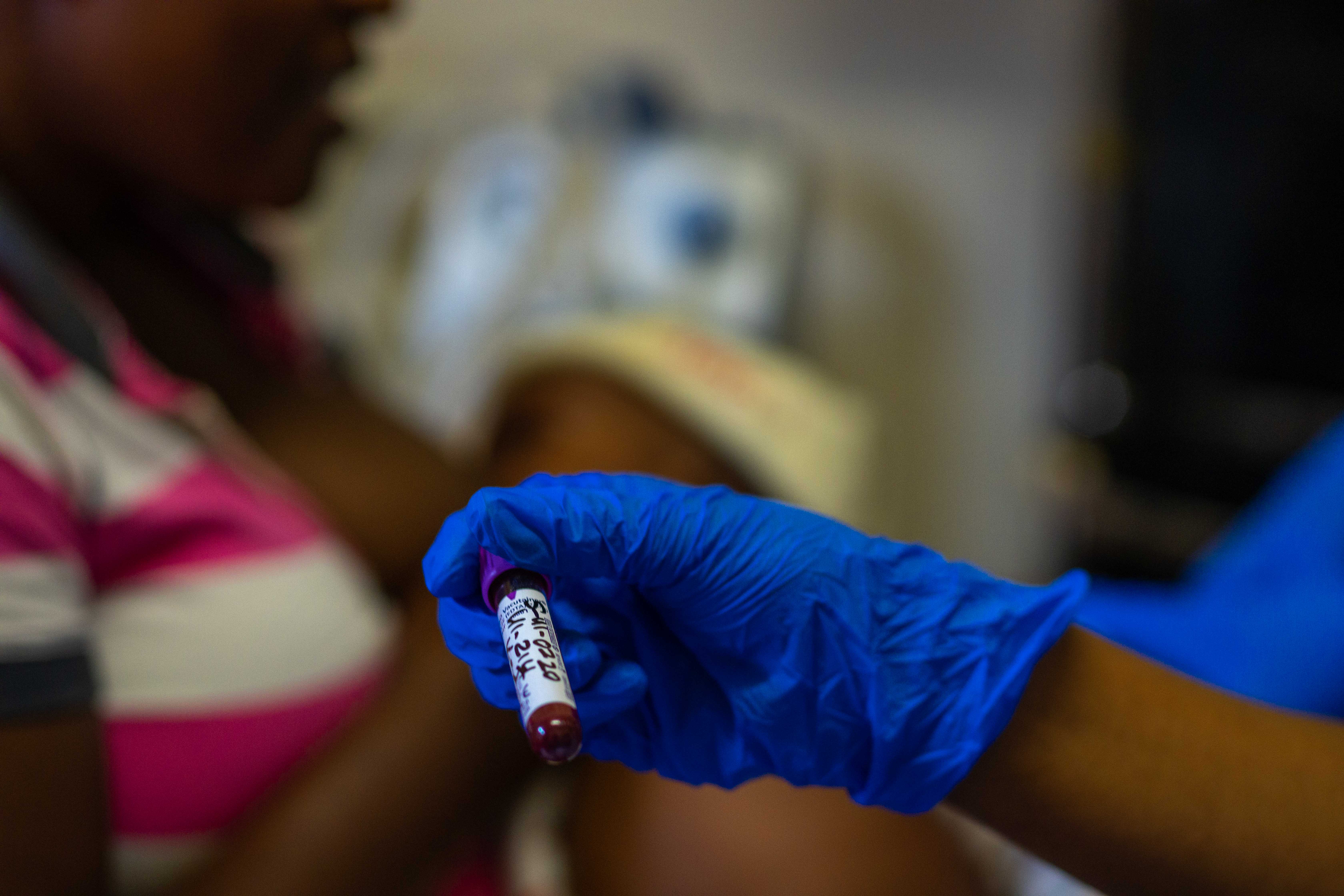 Doctors Without Borders, MSF, World TB day