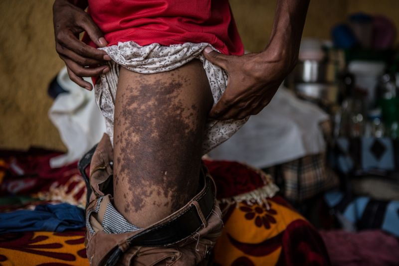 Eritreans, dying to reach Europe