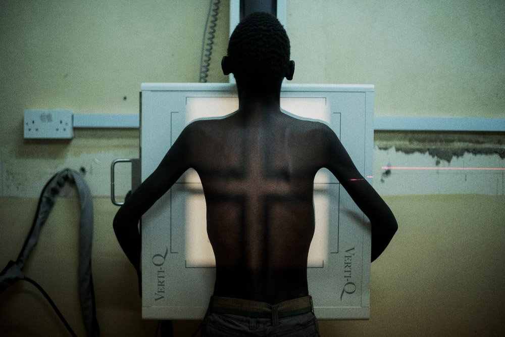 Msf203682 Malawi Hiv