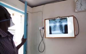 TB treatment at MSF clinic, In Homa Bay District Hospital