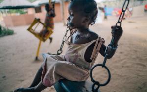 A little girl who was affected by Noma swings in a dusty playground.