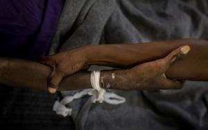 MSF, Doctors Without Borders, Advanced HIV/AIDS 