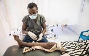 MSF staff cleaning a skin graft for a patient who suffered a severe burn on her leg in October 2021.