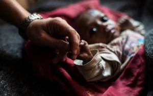 A baby at the Intensive Care Unit in Sadar Hospital, India
