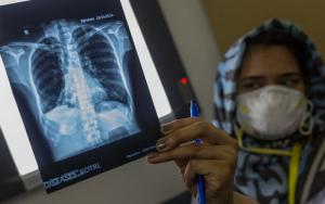 Dr. Muneeba Shaikh looks at the X-ray results of a tuberculosis patient participating in the endTB-Q clinical trial, at the endTB clinic in Pakistan.