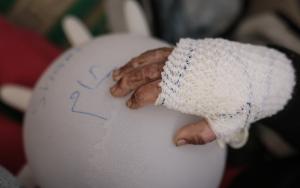 MSF, Doctors Without Borders, MSF survey reveals almost half of people killed in Gaza are children 