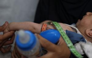 MSF, Doctors Without Borders, Starvation and malnutrition in Gaza 