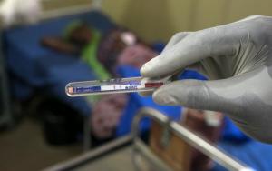 A gloved medical staff member looks at the results of a test. Antibiotic resistance is on the increase.