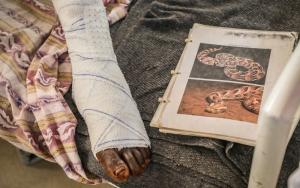 The bandaged foot of a snake bite victim is next to MSF snake bite material
