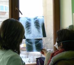  X-rays of a drug-resistant tuberculosis patient. Armenia, February 2014.