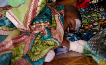 Cameroon - Care for malnourished CAR refugees