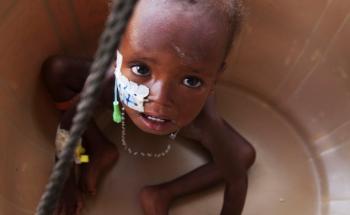 Malnutition in Niger