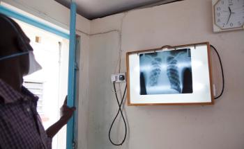 TB treatment at MSF clinic, In Homa Bay District Hospital