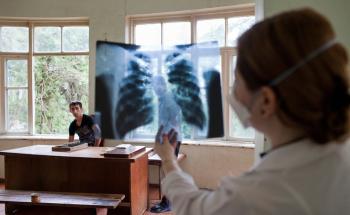 Georgia: DR-TB patients find hope in new treatments
