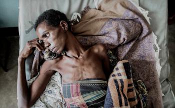 MSF, Doctors Without Borders, IAS, ending Cryptococcal Meningitis, HIV,AIDS