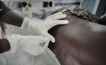 MALAWI. June 29, 2017. Nsanje District Hospital. Emmanuel Frances, 39yo from T.A Ndamera, Mozambique. HIV, TB and meningitis advanced patient.