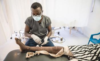 MSF staff cleaning a skin graft for a patient who suffered a severe burn on her leg in October 2021.