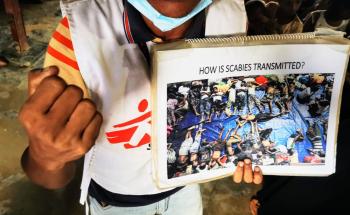MSF, Doctors Without Borders, Scabies, Bangladesh, Rohingya refugee camps