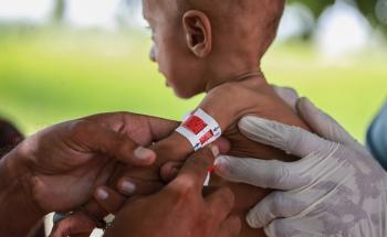 MSF, Doctors Without Borders, Malnutrition 