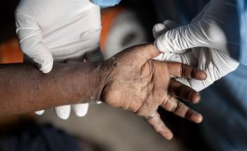 A patient’s hand is being examined by a doctor.