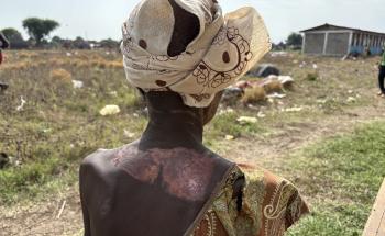Doctors Without Borders, MSF, Sexual and gender based violence