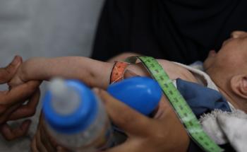MSF, Doctors Without Borders, Starvation and malnutrition in Gaza