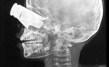 MSF, Doctors Without Borders, Sudan drone attacks 