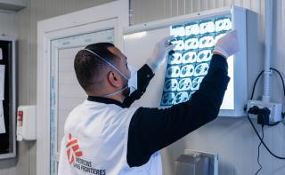 Dr Abdu Samya Bashagha checking X-ray scan of a patient in Abu Sitta Hospital where MSF is running TB support activities