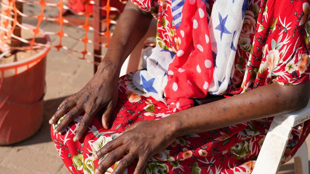 MSF, Doctors Without Borders, A year in Pictures 2025