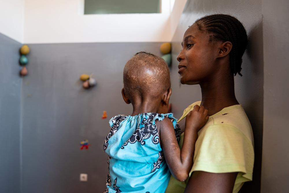 MSF, Doctors Without Borders, A year in pictures, 2023: Malnutrition in Angola