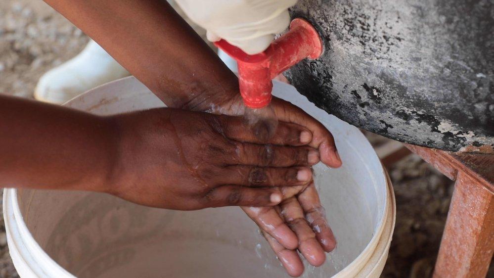 A suspected cholera patient washes hands for infection control purposes at the Glenview Cholera Treatment Centre, Harare.