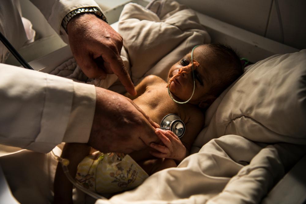 A baby being examined in the neonatal care unit at Boost Hospital, Afghanistan