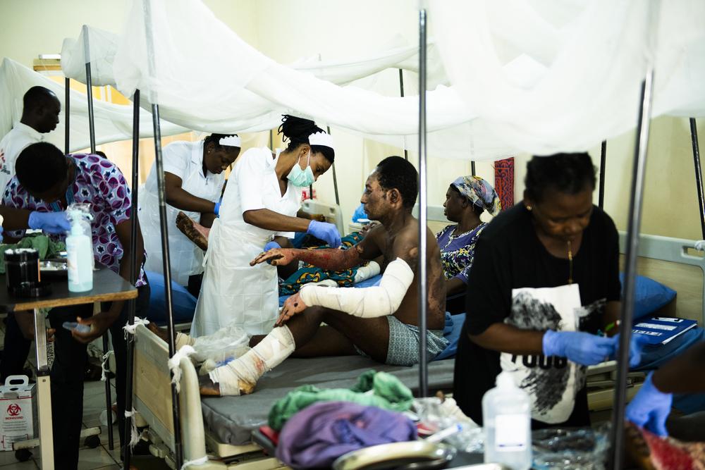 Burns unit of Benue State University Hospital Nigeria, August 2019.