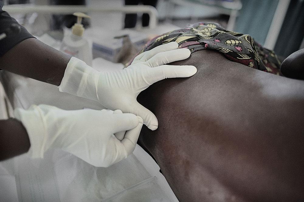 MALAWI. June 29, 2017. Nsanje District Hospital. Emmanuel Frances, 39yo from T.A Ndamera, Mozambique. HIV, TB and meningitis advanced patient.