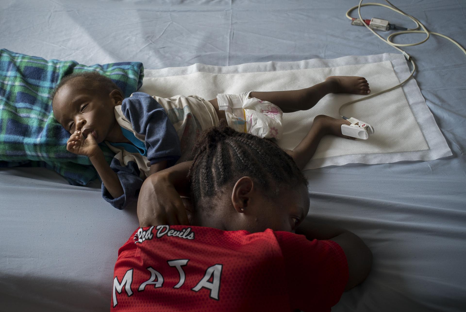 Patient Esther rests her head next her son Anthony, in the Malnutrition ward of the MSF Hospital in Monrovia, Liberia. Sept. 27, 2016 