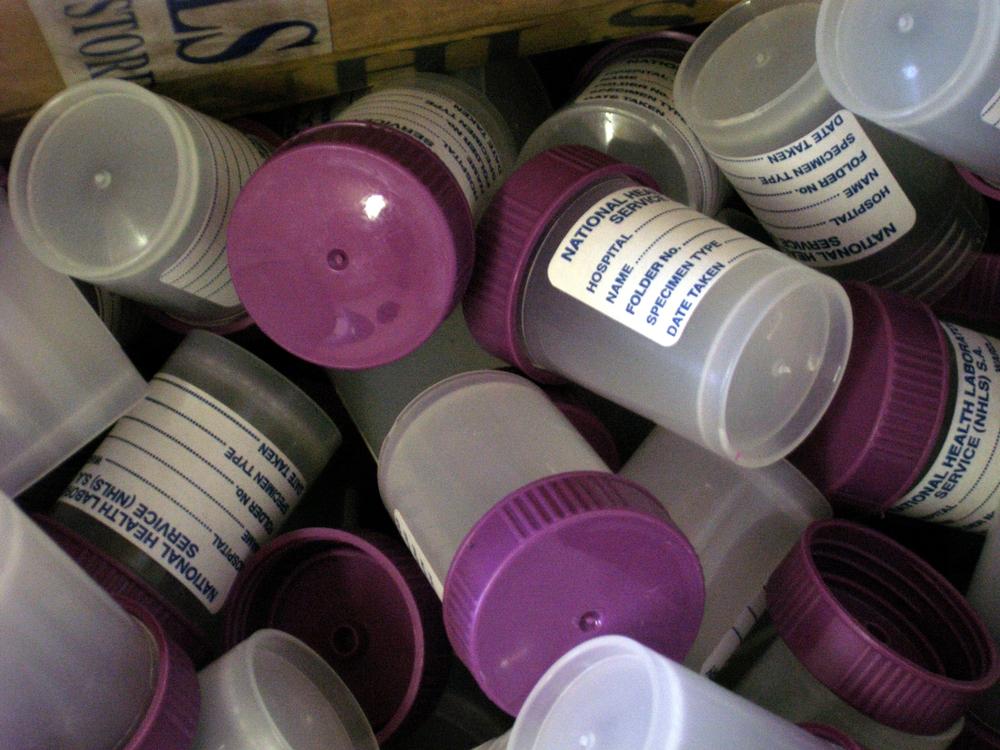 TB and HIV/AIDS medication at Site B clinic in Khayelitsha