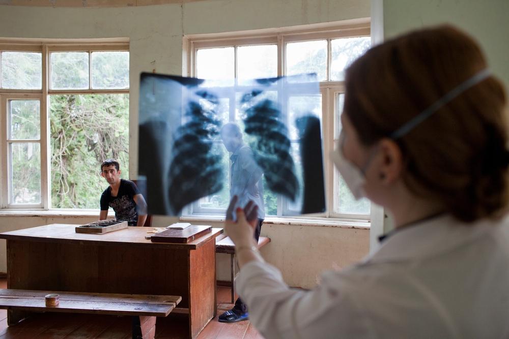 Regional Centre of Infectious Pathology, AIDS and Tuberculosis in Georgia, July 2016.