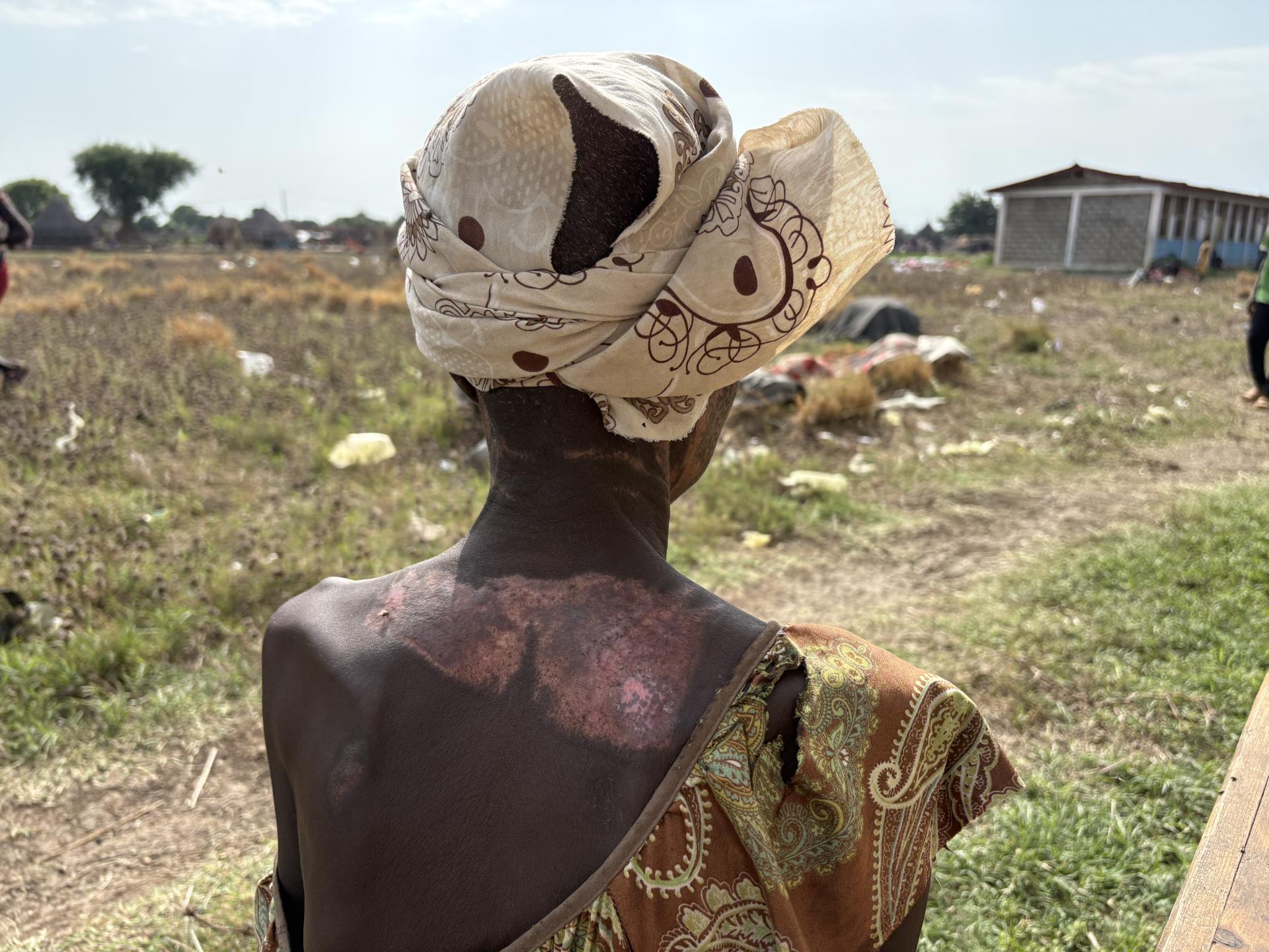 Doctors Without Borders, MSF, Sexual and gender based violence