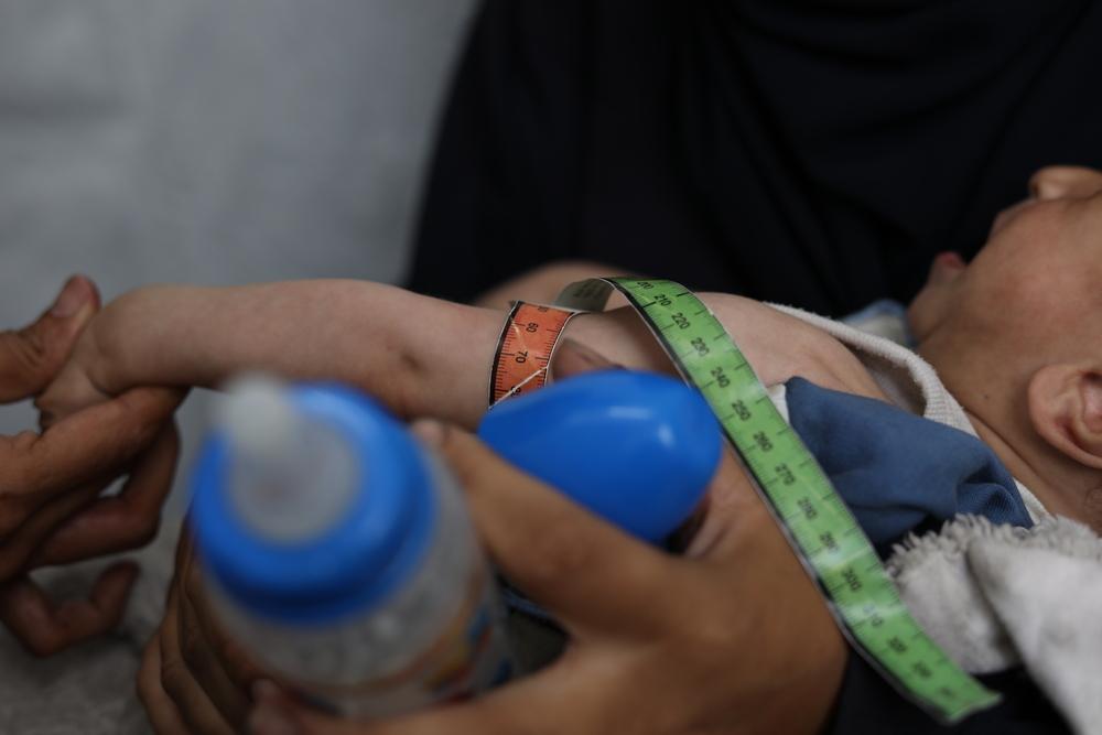 MSF, Doctors Without Borders, Starvation and malnutrition in Gaza 
