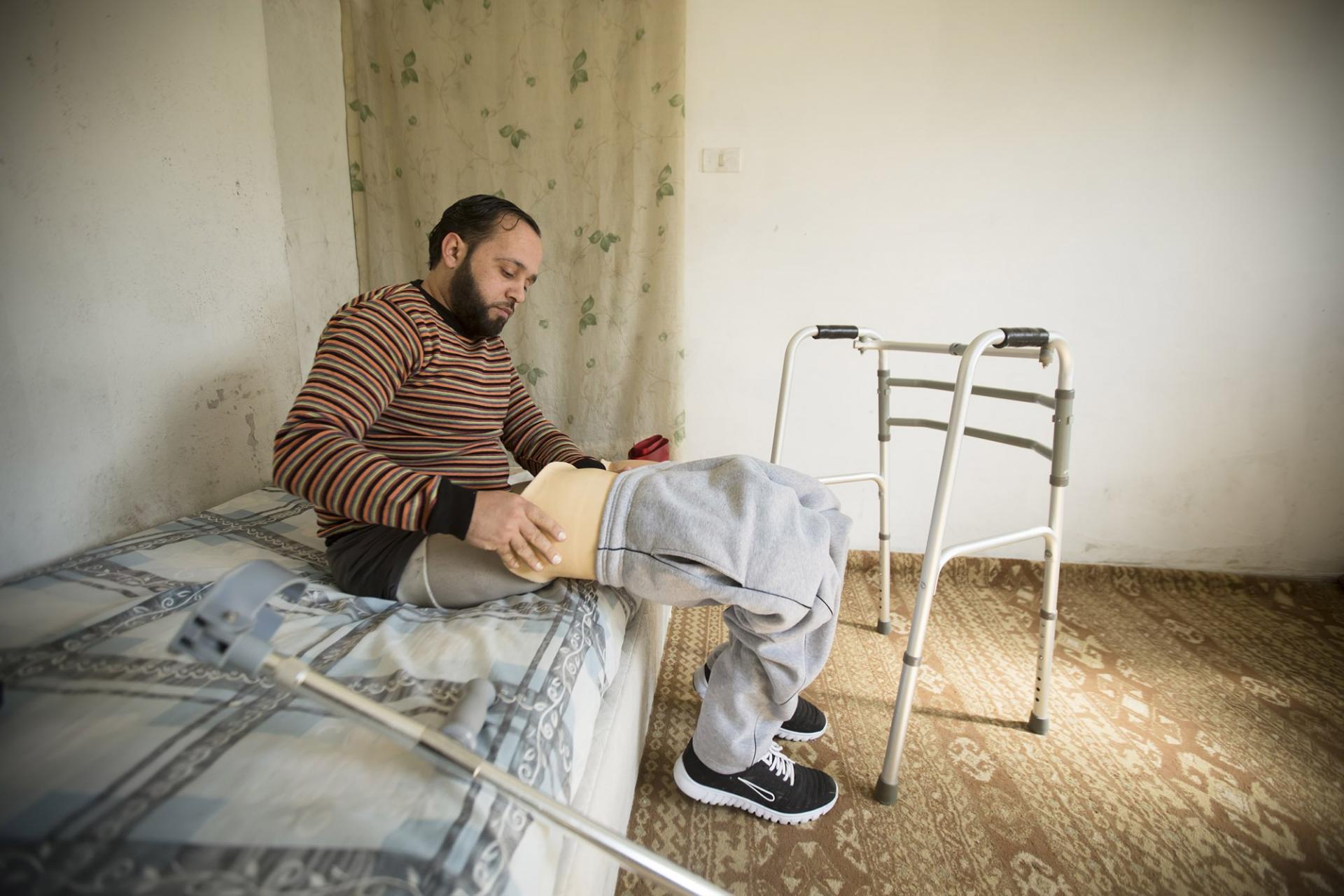 Syria, MSF, War-wounded Patient