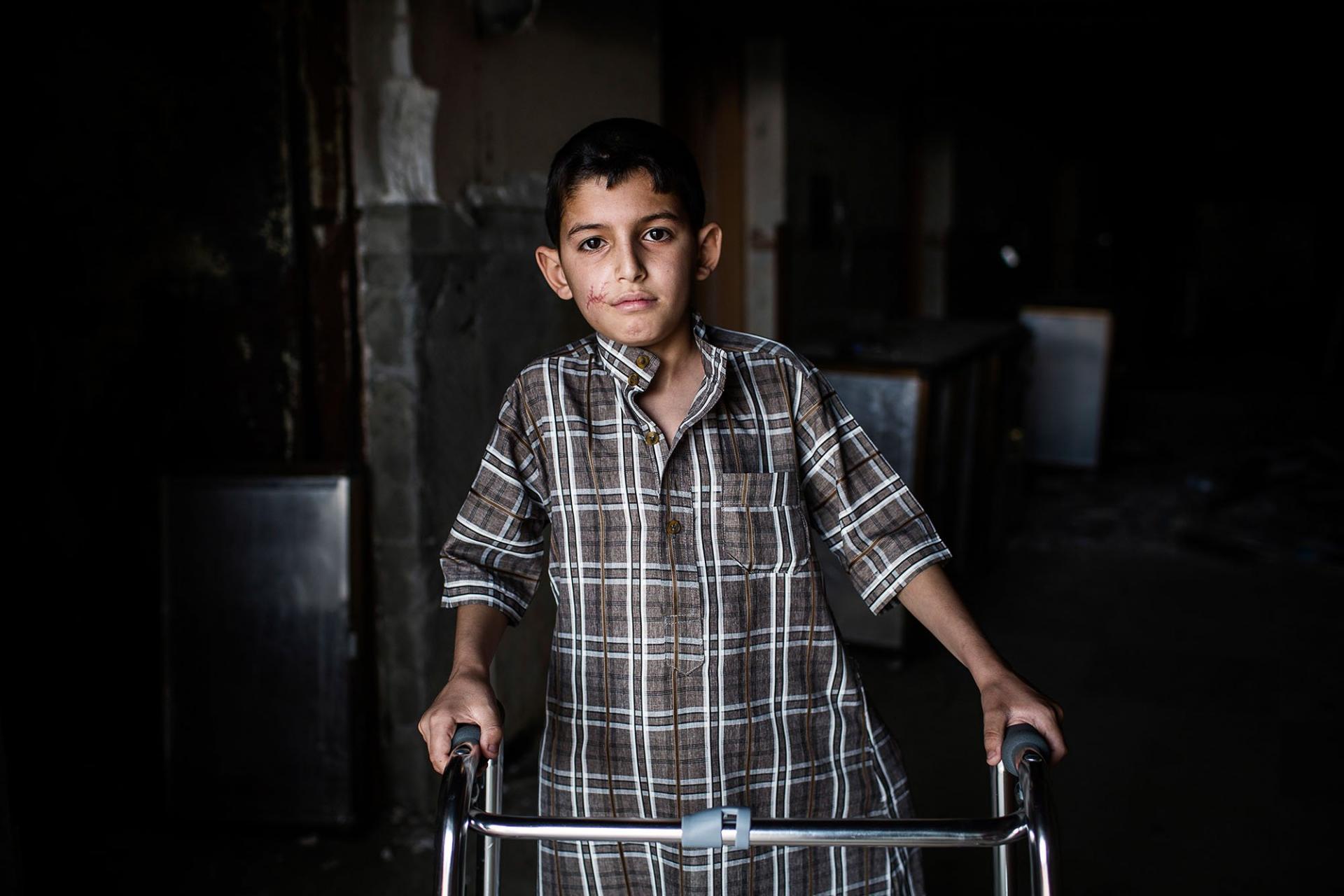 Iraq, patients mostly children