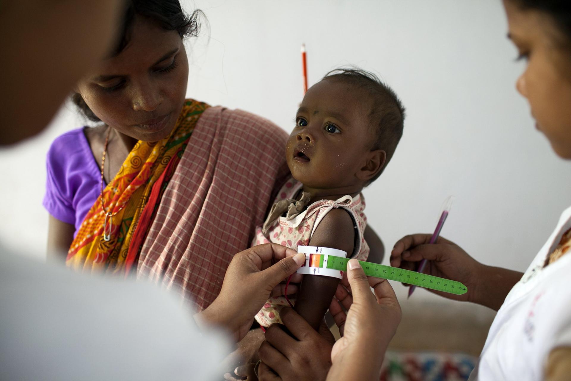 MSF, India, Malnutrition