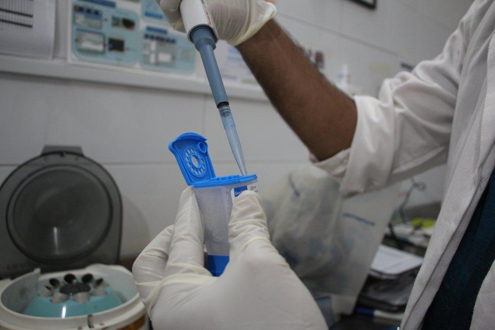 LLab technician Javed Akhtar prepares samples for testing for hepatitis C.